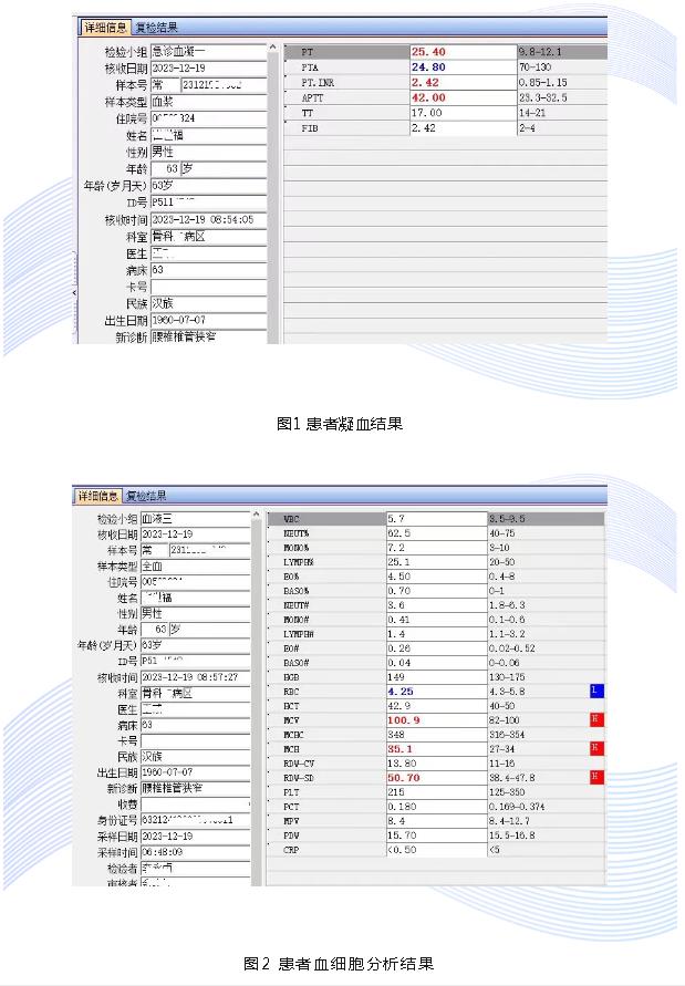 “有温度的检验人”系列报道（二十二）PT、APTT同时延长，临床补充维生素K后无效怎么办?